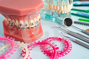 Orthodontic ligatures rings and ties, elastic rubber bands on orthodontic braces, model for dentist studying about dentistry photo