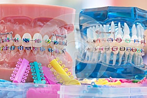 Orthodontic model.