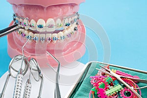 Orthodontic model.