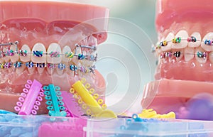 Orthodontic model.