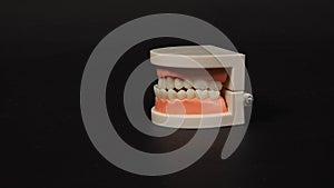 Orthodontic model of teeth isolated on black background.For dental care and no people