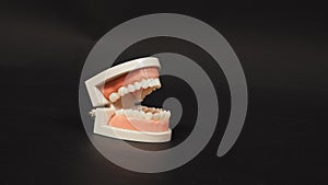 Orthodontic model of teeth isolated on black background.For dental care and no people