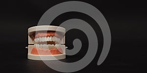 Orthodontic model of teeth isolated on black background.no people