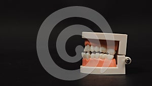 Orthodontic model of teeth isolated on black background.no people