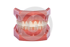 Orthodontic Model used in dentistry for demonstration and educational purposes