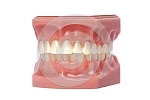 Orthodontic Model used in dentistry for demonstration and educational purposes