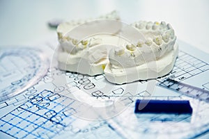 Orthodontic molds photo