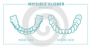 Orthodontic silicone trainer. Invisible braces aligner, retainer.