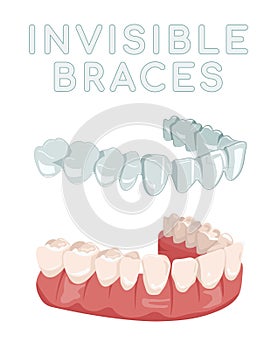 Orthodontic silicone trainer. Medical drawing in cartoon style.