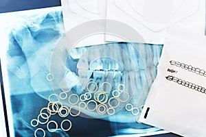 Orthodontic teeth braces latex rubber rings, xray photo