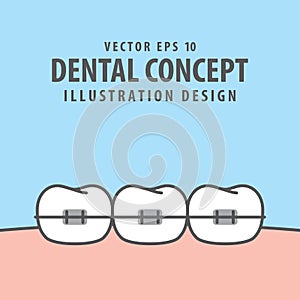 Orthodontic teeth illustration vector on blue background. Denta