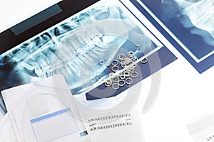 Orthodontic tools and xray on the table photo