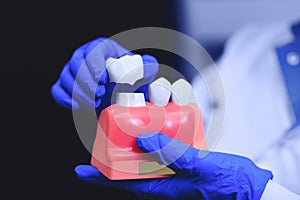 Orthodontic treatment with dental implants. Dental implants.