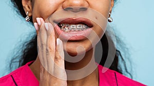 Orthodontic treatment. Teeth with braces