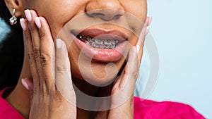 Orthodontic treatment. Teeth with braces