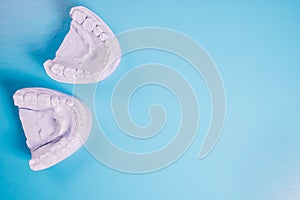 Orthodontics dental mold on blue background