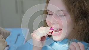 Orthodontist doctor installing silicone transparent braces on girl`s teeth.