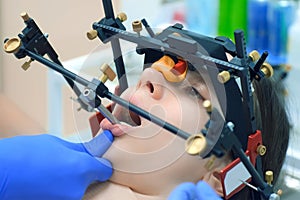 Orthodontist is doing condylography procedure examining mandibular joints.