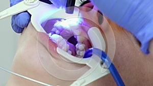 Orthodontist fixes ligature braces on teeth of client. Close up of teen at appointment in dental clinic. Concept of