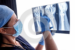 Orthopaedic surgeon studying a x-ray of a broken radius bone in theatre after correctional surgery