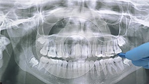 Orthopantomography, OPG X-ray DR digital. Dental Xray of jaw with teeth