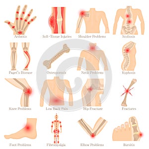 Orthopedic diseases icons set, cartoon style