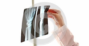 Orthopedic doctor examines image of hands on x-ray