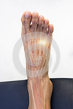Foot pain in Morton neuroma syndrome with transparent anatomy of nerve. photo