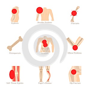 Orthopedic icons set, cartoon style