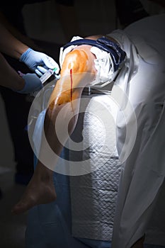 Orthopedics surgery knee arthroscopy anaesthetic