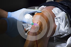 Orthopedics surgery knee arthroscopy anaesthetic