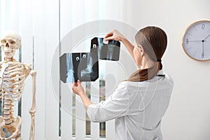 Orthopedist examining X-ray pictures in office