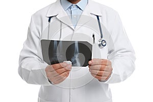 Orthopedist holding X-ray picture on background, closeup