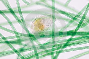 Oscillatoria is a genus of filamentous cyanobacterium, oscillation in its movement under the microscope.