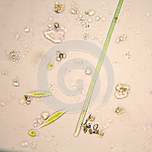 Oscillatoria simplicissima and Euglena Gracilis