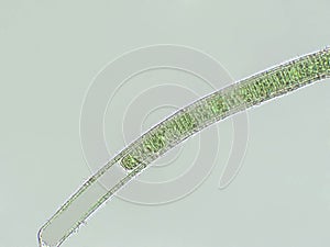 Oscillatoria sp. algae under microscopic view x40
