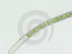 Oscillatoria sp. algae under microscopic view x40 photo