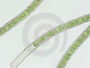 Oscillatoria sp. algae under microscopic view x40, cyanobacteria, blue green algae