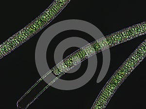 Oscillatoria sp. algae under microscopic view x40, dark background photo