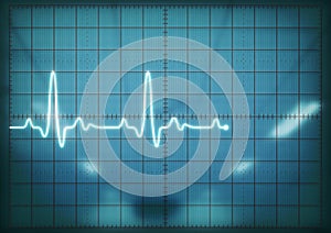 Oscilloscope screen showing heartbeat