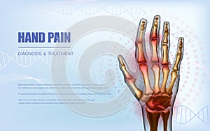 Osteoarthritis rheumatoid arthritis hand sore joints concept photo