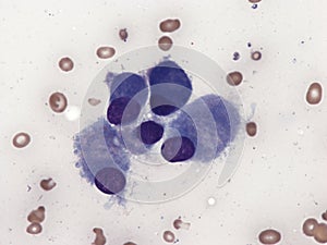 Osteoblasts in bone marrow.