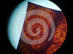 Osteocyte; osteocytes; bone cell