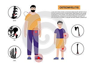 Osteomyelitis children and adults