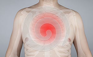 Osteomyelitis of the thoracic skeleton and spine. An X-ray of bones and cartilage is superimposed on photo of man. Concept of