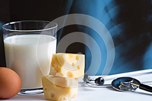 Osteoporosis calcium dairy product and x-ray photo photo