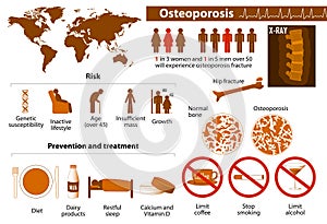 Osteoporosis infographic