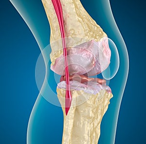 Osteoporóza z koleno kloub 