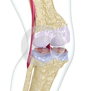 Osteoporosis of the knee joint. Isolated on white.