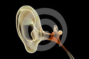 Otitis media, illustration